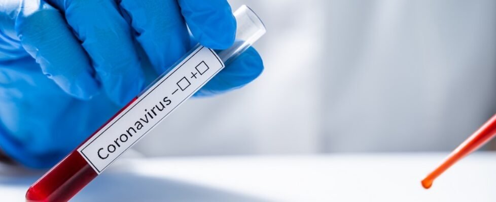 Laboratory assistant tests blood for new coronavirus from China 2019-nCoV