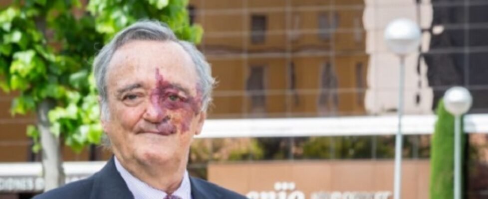 axa mariano barbacid