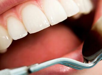 Sanitas salud-bucodental