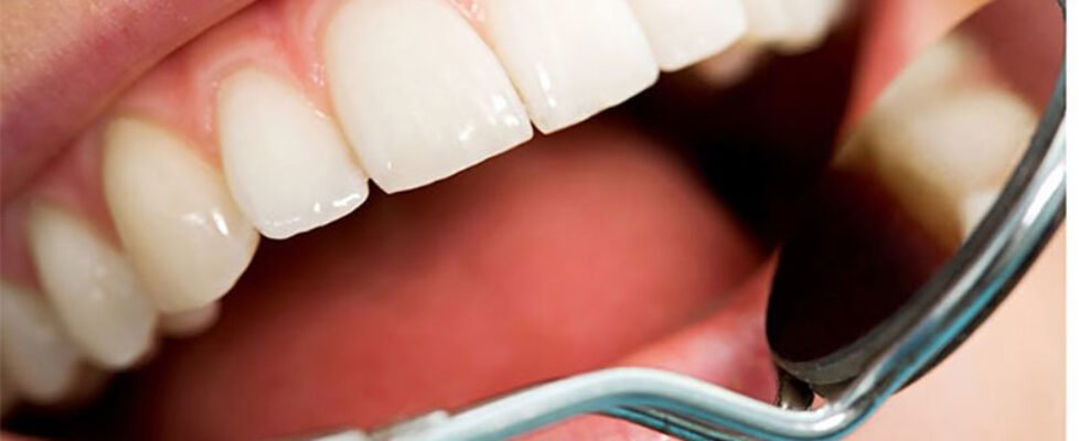 Sanitas salud-bucodental