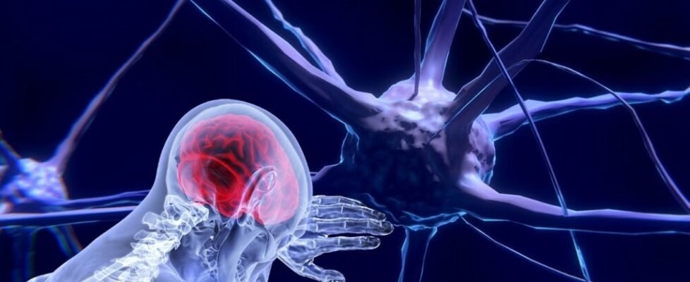 Grupo Init dolor crónico