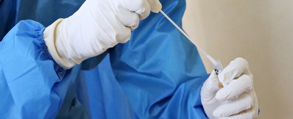 TEST-ANTICUERPOS-mapfre covid