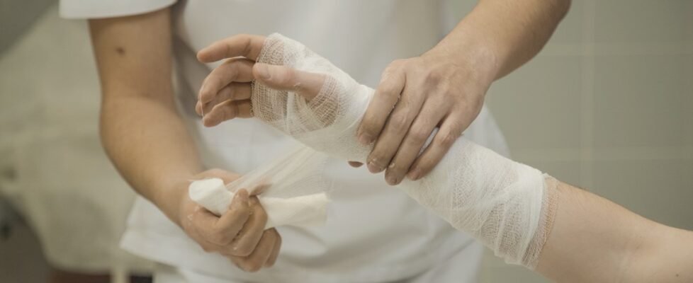 Doctor puts gypsum pad on patient's hand
