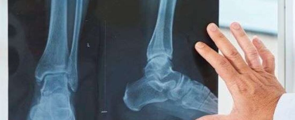 DKV radiograf_a_sucesiva_de_tobillo_y_pie_proyecciones_sucesivas_