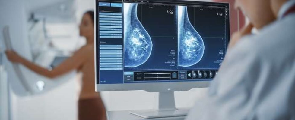 Computer,Screen,In,Hospital,Radiology,Room:,Beautiful,Multiethnic,Adult,Woman