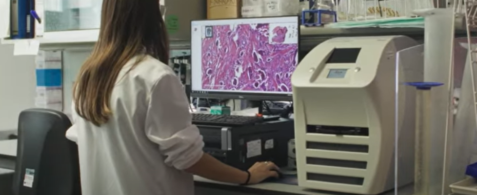 Sabadell cáncer mama