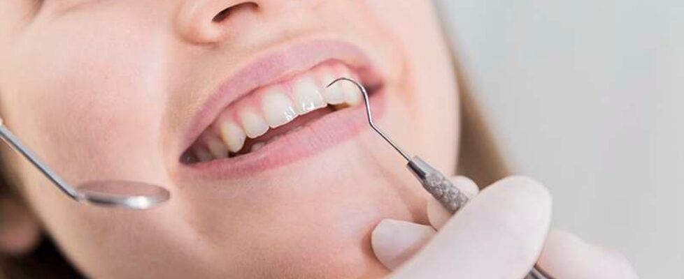 seguro dental - free